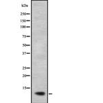 NDUFB2 Polyclonal Antibody