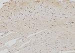 NOC4L Polyclonal Antibody
