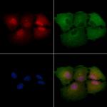 EPB41 Polyclonal Antibody