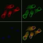 RIOK2 Polyclonal Antibody