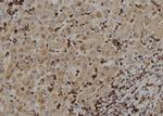 RIOK2 Antibody in Immunohistochemistry (Paraffin) (IHC (P))