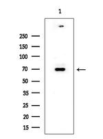 RIOK2 Antibody in Western Blot (WB)