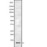 CCL23 Polyclonal Antibody