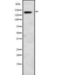 SCN3A Polyclonal Antibody