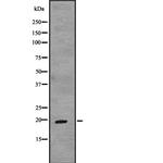 TCAP Polyclonal Antibody