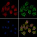 eIF2b beta Polyclonal Antibody