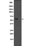 TSEN2 Polyclonal Antibody