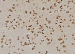 USP1 Polyclonal Antibody