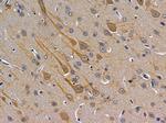 Adenylate Cyclase 8 Polyclonal Antibody