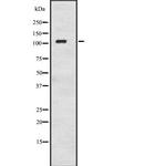 Adenylate Cyclase 8 Antibody in Western Blot (WB)