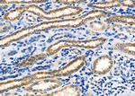 PPP1R13B Polyclonal Antibody