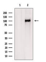 PPP1R13B Antibody in Western Blot (WB)