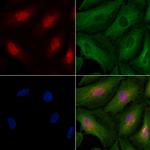 Cyclin T2 Polyclonal Antibody