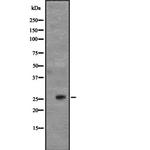 CD63 Polyclonal Antibody