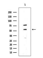 CDK8 Polyclonal Antibody