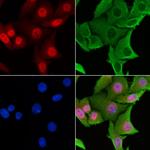 CENPL Polyclonal Antibody