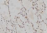 CENPL Antibody in Immunohistochemistry (Paraffin) (IHC (P))
