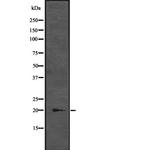 CENPM Antibody in Western Blot (WB)