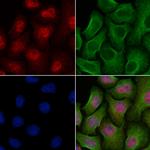 CENPN Polyclonal Antibody