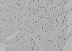 CENPN Antibody in Immunohistochemistry (Paraffin) (IHC (P))