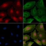 CENPT Polyclonal Antibody