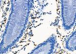 CXCR5 Polyclonal Antibody