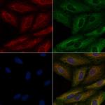 CYLC1 Antibody in Immunocytochemistry (ICC/IF)