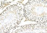 CYLC1 Antibody in Immunohistochemistry (Paraffin) (IHC (P))