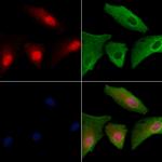 FAM58A Polyclonal Antibody