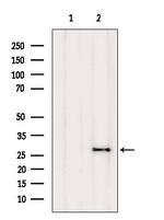 FAM58A Antibody in Western Blot (WB)