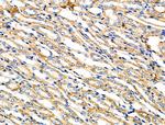 ZPK Polyclonal Antibody