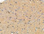 ZPK Antibody in Immunohistochemistry (Paraffin) (IHC (P))