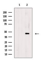 RAD9B Antibody in Western Blot (WB)