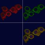 MT-CYB Polyclonal Antibody