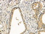 MT-CYB Antibody in Immunohistochemistry (Paraffin) (IHC (P))