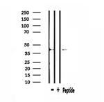 MT-CYB Antibody in Western Blot (WB)