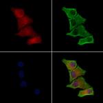 Laminin beta-3 Polyclonal Antibody