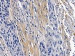 Laminin beta-3 Antibody in Immunohistochemistry (Paraffin) (IHC (P))