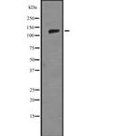 Laminin beta-3 Antibody in Western Blot (WB)