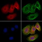 VPARP Polyclonal Antibody