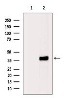 PHLDA1 Polyclonal Antibody