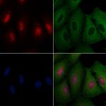 ZNF750 Polyclonal Antibody