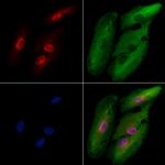 TAF7L Polyclonal Antibody
