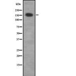 MRCK gamma Polyclonal Antibody
