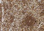 ZNF497 Antibody in Immunohistochemistry (Paraffin) (IHC (P))