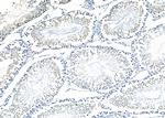 ZNF497 Antibody in Immunohistochemistry (Paraffin) (IHC (P))