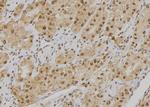 POGZ Polyclonal Antibody