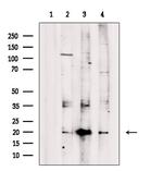 GKN2 Polyclonal Antibody