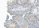 HOMEZ Antibody in Immunohistochemistry (Paraffin) (IHC (P))