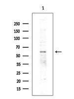 ZNF440 Antibody in Western Blot (WB)